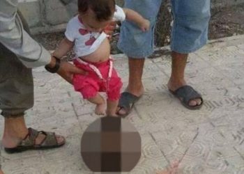 بالصورة: رضيع داعشييركل رأسًا مقطوعًا!