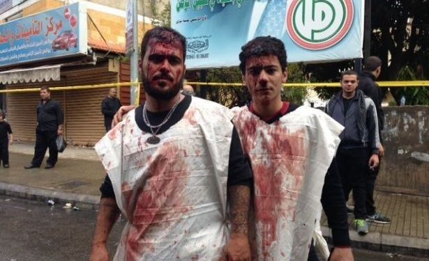 هكذا يضربون حيدر في الضاحية : احترمونا لنحترمكم
