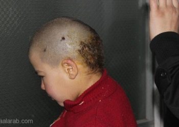 مرض خطير وشبه منقرض يعاود الظهور في الغوطة الشرقية!