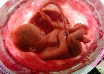 امرأة حاولت التخلص من الجنين ولكن كانت الصدمه ..!!!!