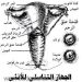 لماذا تلجأ بعض النساء الى ربط عنق الرحم