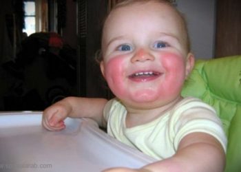 المدن الكبيرة تسبب الحساسية للأطفال