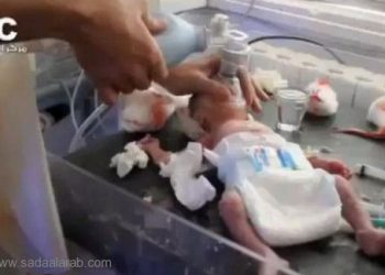 جنين يخرج من الرحم وبرأسه شظية من جيش الأسد