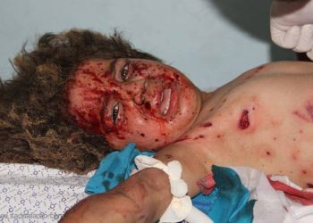 أطفال غزة بنك أهداف الطائرات الإسرائيلية والعدوان حصد 250 شهيداً