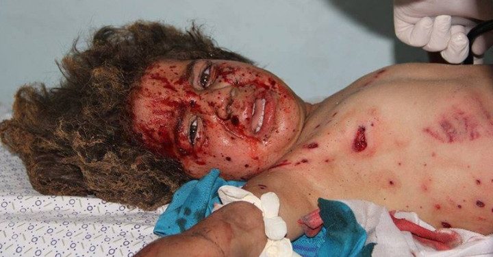 أطفال غزة بنك أهداف الطائرات الإسرائيلية والعدوان حصد 250 شهيداً
